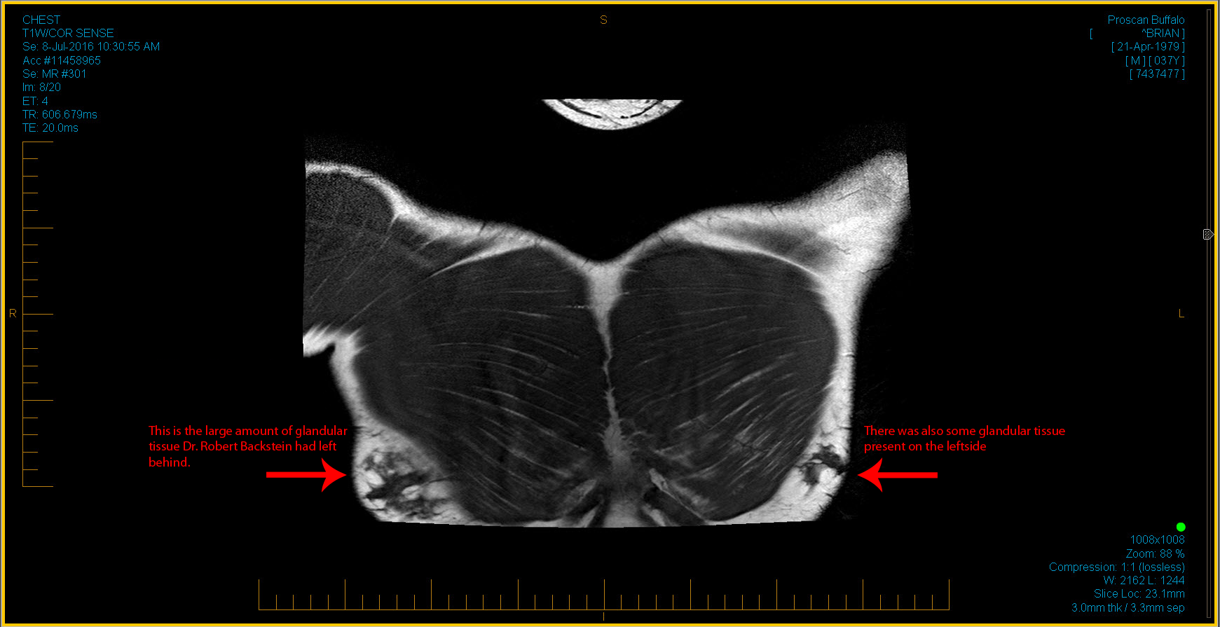 MRI Image